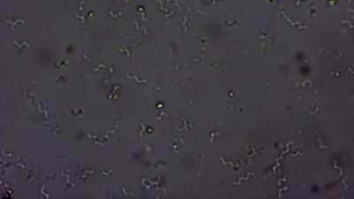 Spirilla bacteria before and after salt addition