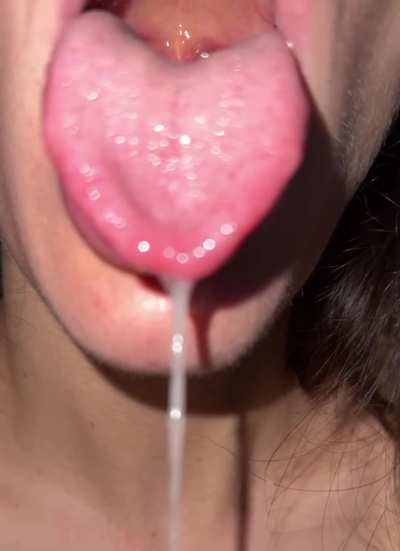 Would you let all this drool fall on you?