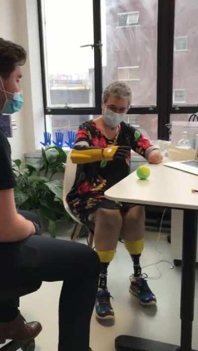 Caroline survived COVID, Kidney failure, Sepsis, and a quadruple amputation. See her joy using her new bionic hand for the first time. :)