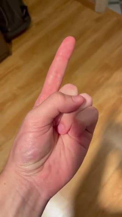 Footage of me attempting to snap using only one finger
