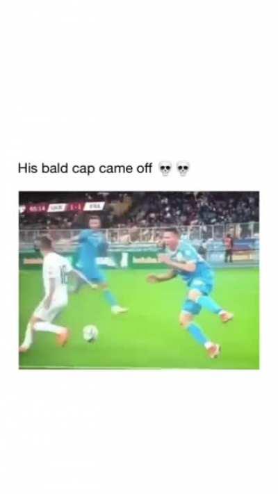 One bald fraud down few more to go