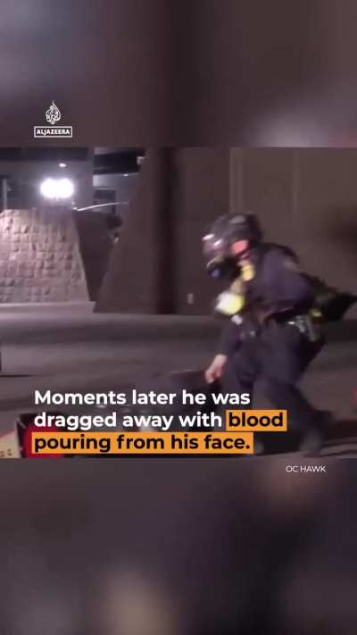 OMG ,He became completely blind in his left eye.