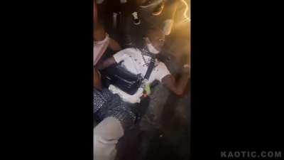 Lady Fucks Amputee Arm Stump