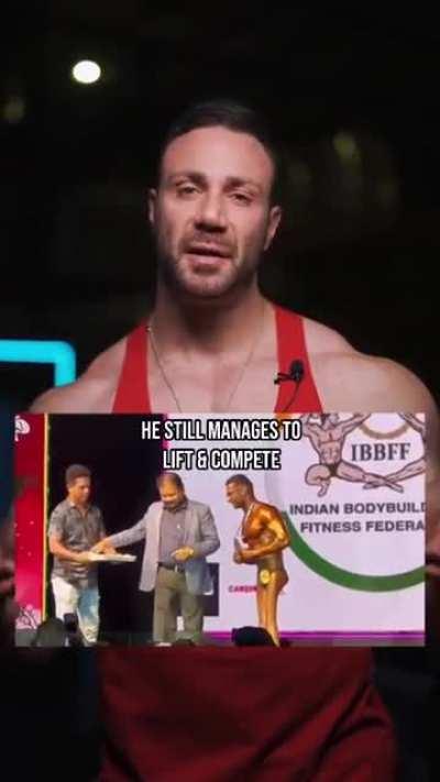 Chadtopian icon Noel Deyzel rebuts hurtful comments directed at a bodybuilder who survived Polio