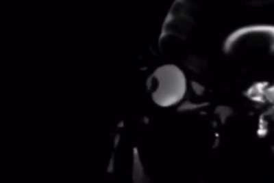 What rubbing your eyes looks like through an MRI scanner