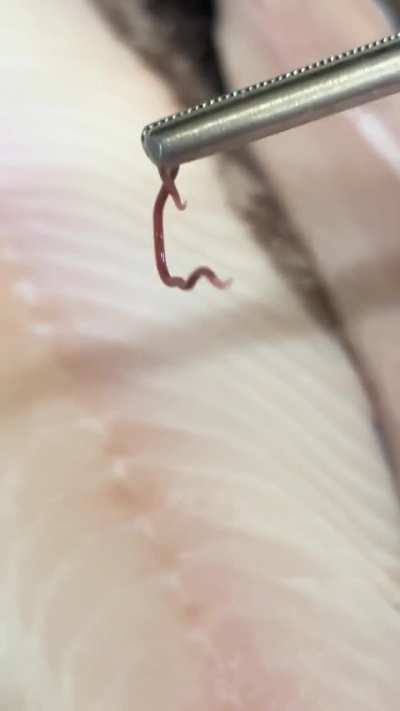 Why you should only eat raw fish that’s been frozen