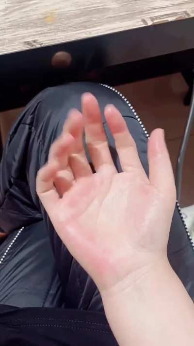 Some people are born with six fingers dure to a rare genertic trait called polydactyly. It's sometimes fully functional and even considered lucky!