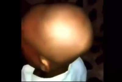 bald ass