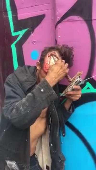 Guy combing his skull