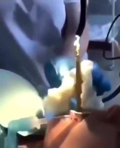 Medics pull 4ft snake from woman’s mouth after it slithered down there while she slept.