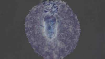 The Cruel Lymphocyte's Thesis