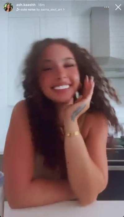 😍 but them veneers be killing me