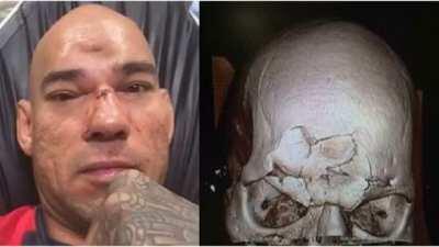 MMA fighter gets his skull caved in from a flying knee. The sound of it will stay with you for life