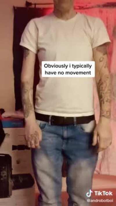 Woman with a paralyzed arm moves it