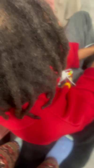 Traction alopecia or balding also do it look savable 