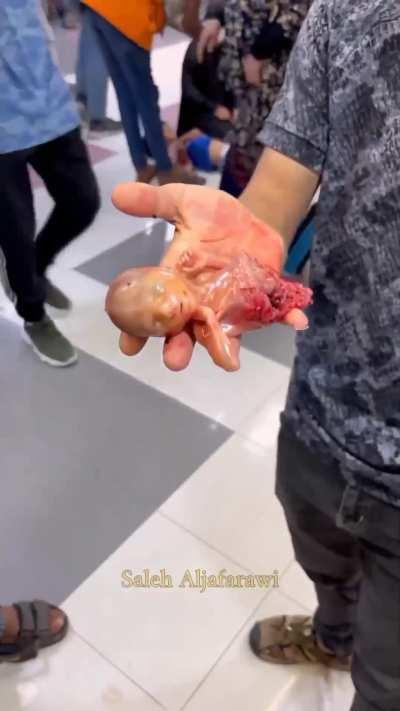 War [extremely graphic]