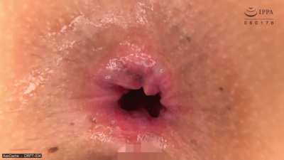 Closeup Asian anal gape
