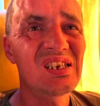 Russian POWs documented by the Ukrainians during an exchange — their missing teeth proving that chewing propaganda does not improve dental hygiene