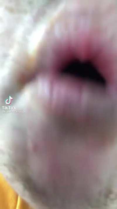 You can see the bacteria in his mouth