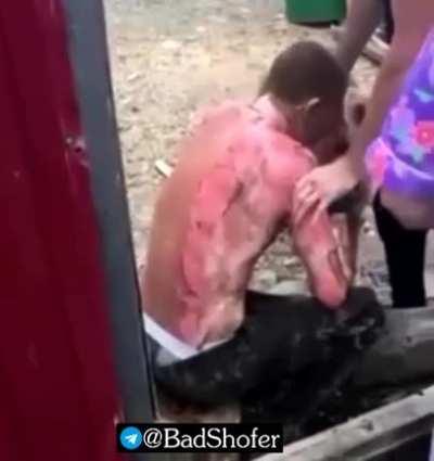 Near Vladivostok, summer residents caught electricity thieves, the suspect set them on fire with a flamethrower and fired a harpoon