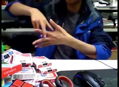 Whoa! This guy can remove his fingers!