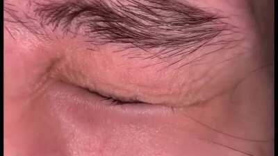 I can tuck my bottom eye lid with my top eye lid