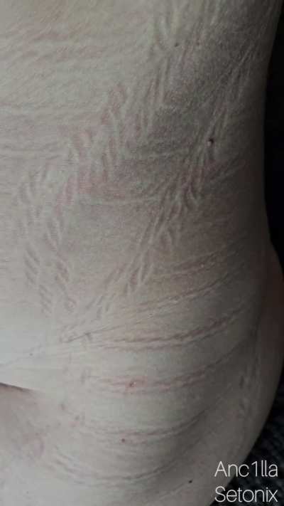 After a while of being tied up, it was time to set me free again. It took 25 minutes to remove the 64 meters of rope. They left so many rope marks on my body! It is two weeks later now and I still have a few marks left on my body