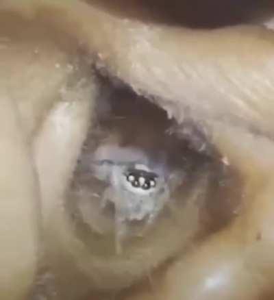 Spider in an ear canal. Happy Halloween!