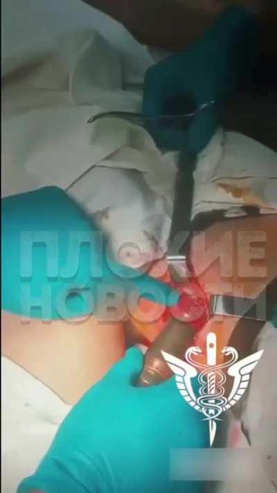 a Russian soldier caught a Ukrainian 30mm projectile in the thigh He got stuck there, that's why Katsap, in such a state of loneliness, rushed to the medics.