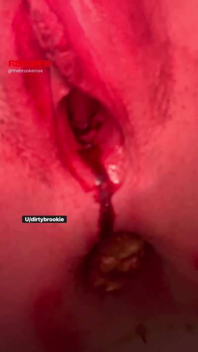 Pooping on my period.