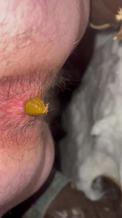 Wifey pooping in the snow ❄️ the other night 