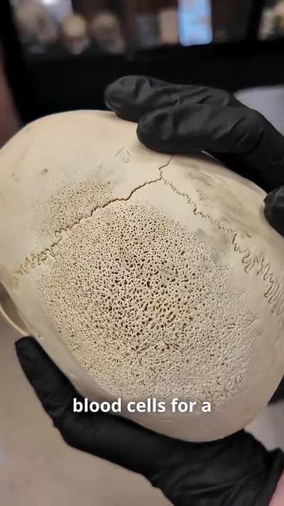 What anemia does to bone