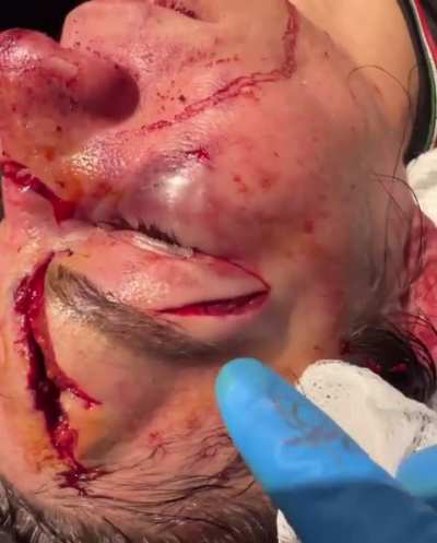 Prelim headliner suffers one of the worst cuts the sport has seen in a while. 