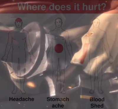 Where does it hurt?