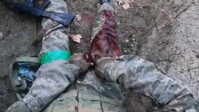 UA POV: Ukrainian soldier received a sharpnel to the leg and applies a tourniquet while screaming