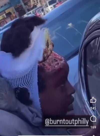 Necrotic woman shoots heroin into skull in Philly