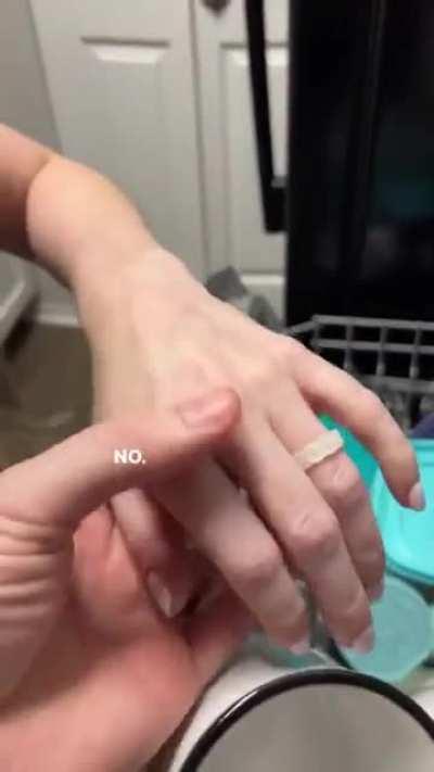 The dishwasher is broken.