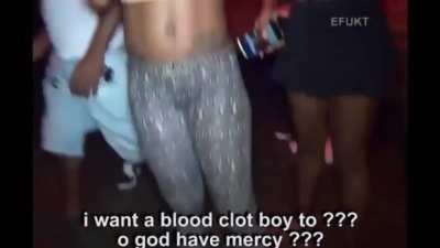 DJ sets girl's ass on fire