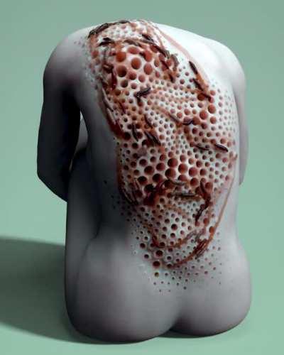 Thanks, I hate bed bugs.