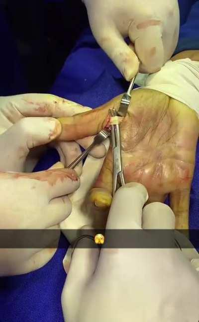 For some reason I could feel this