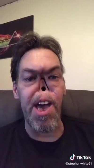 Man with no nose hate's ex-wife