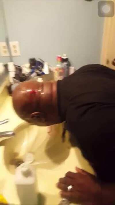 [TW Blood] He used a cheap razor to shave his head now they putting alcohol on it. bro i’m so weak😭😭😭