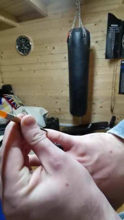 Pulling a dart out of my finger. Didn't hurt at the time but the next morning it was killing me