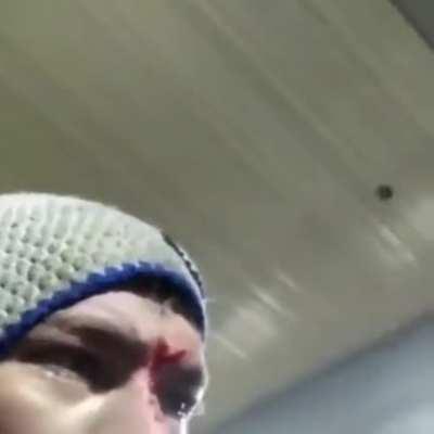 WCGW using a grinder without safety glasses