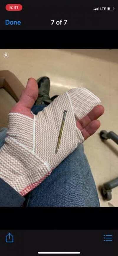 My buddies hand and a nail.