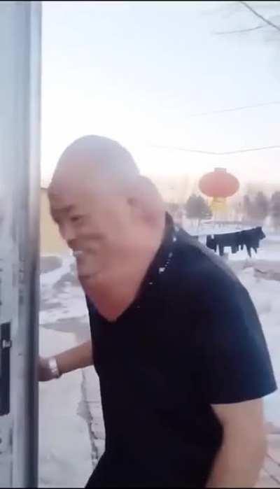 I know this is a real condition but DAMN they did him BAD