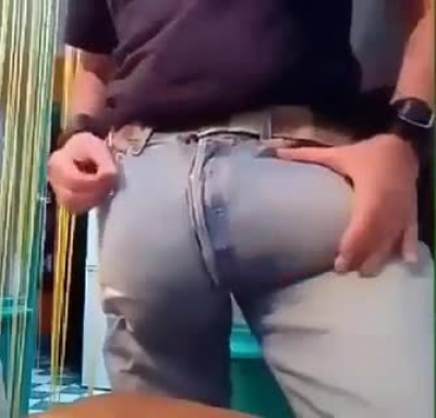 This is possibly the worst surgery gone wrong I’ve ever seen. I thought it was natural, like Elephantiasis at first and he was showing his struggle- then I saw how proud he was and with horror, realised he had most likely done this to himself 🤭