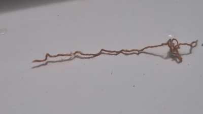 What is this. It Came out of my face