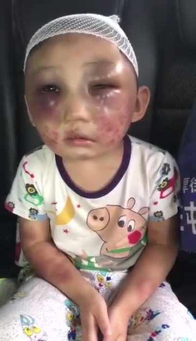 母蜘蛛暴打小蜘蛛,小蜘蛛变成花蜘蛛,旁者询问还说不疼,看来是母蜘蛛教育的好,说疼听见了继续打