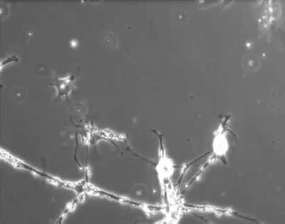 Células cerebrais em um prato de cultura tentando formar conexões entre si